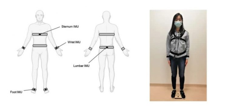 Les capteurs portables suivent avec plus de précision la progression de la maladie de Parkinson que l’observation traditionnelle