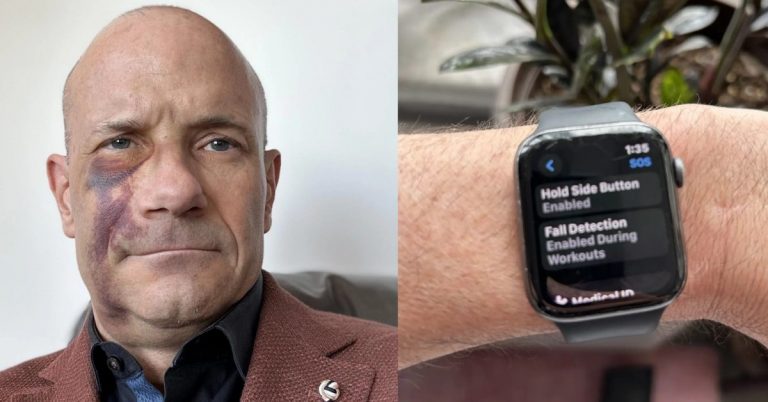 La détection de chute de l’Apple Watch aide à sauver un cycliste après un accident lors d’une averse